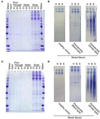 Identification and Modification of Porphyromonas gingivalis Cysteine Protease, Gingipain, Ideal for Screening Periodontitis